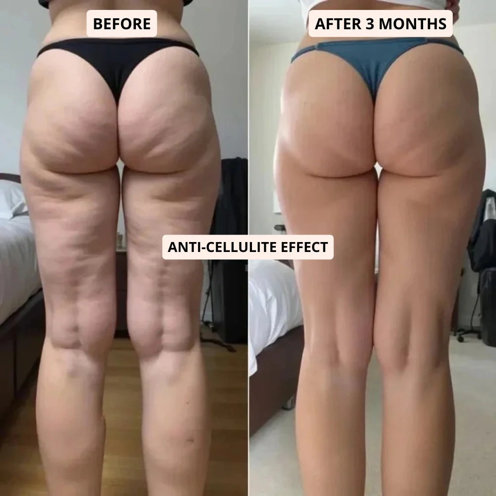 CELLUMOVE™ || 3D Metabolic Booster Leggings - Image 5