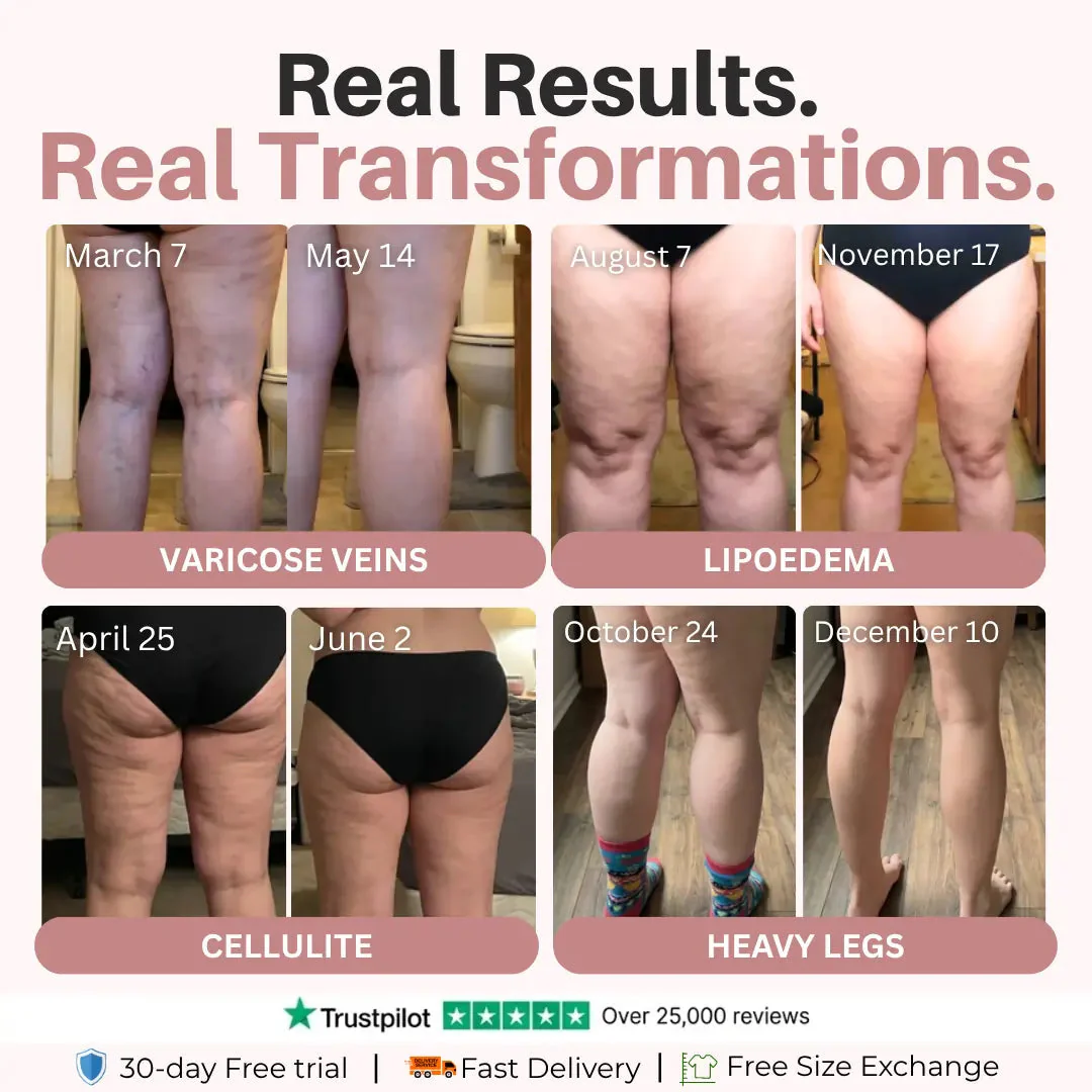 Cellumove 3D Legging — Daily lymphatic drainage - Image 4