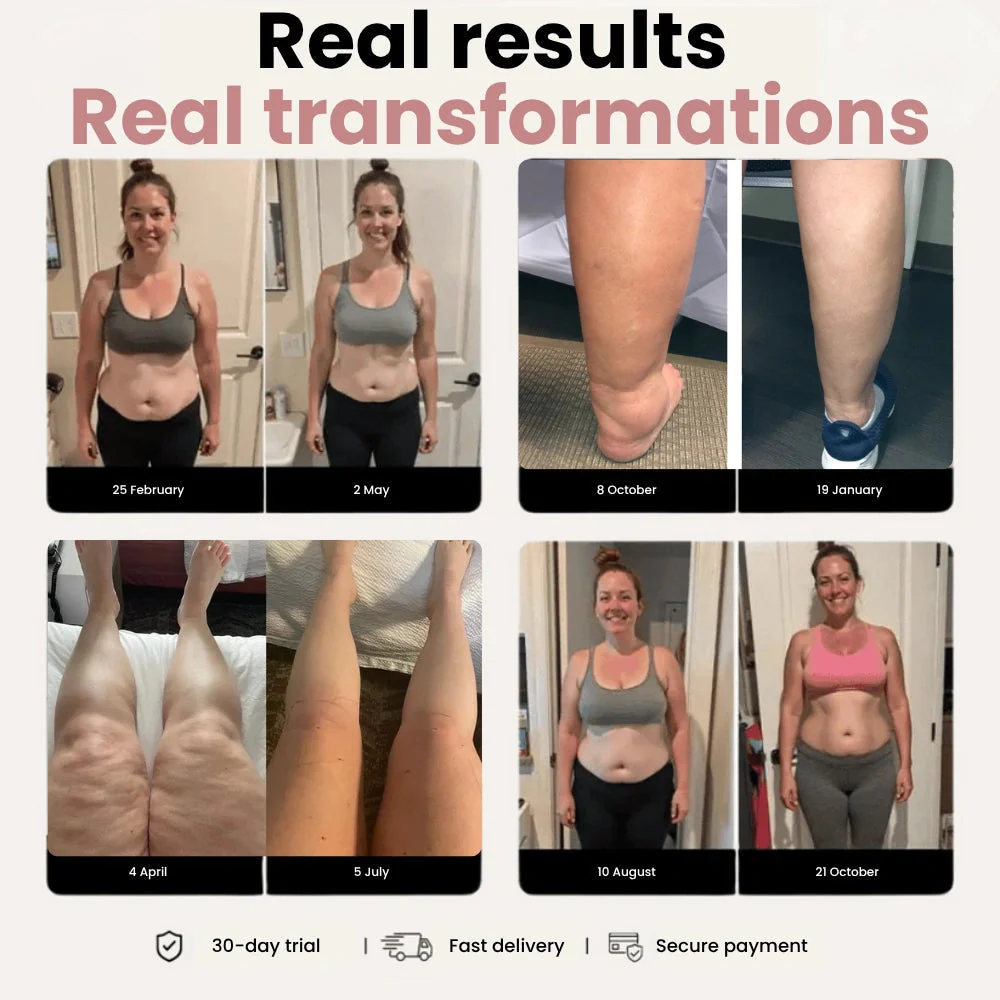 Cellumove 3D Legging – Designed to reduce post-partum swelling and restore comfort naturally. - Image 5