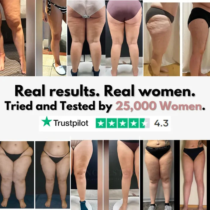 Cellumove 3D legging - say goodbye to lipedema pain and swelling naturally - Image 8