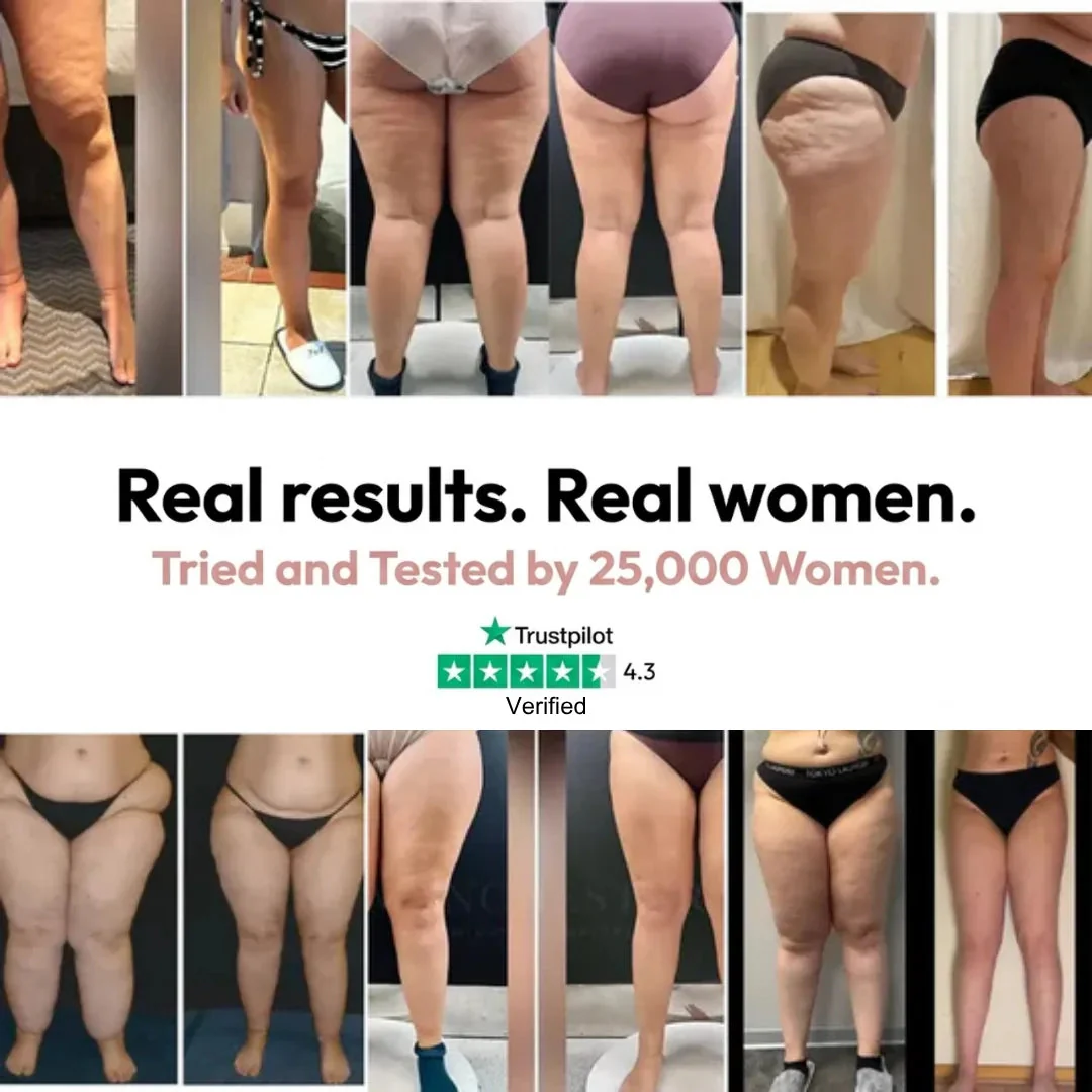 Cellumove 3D Legging – Say goodbye to lipoedema pain and swelling naturally - Image 6