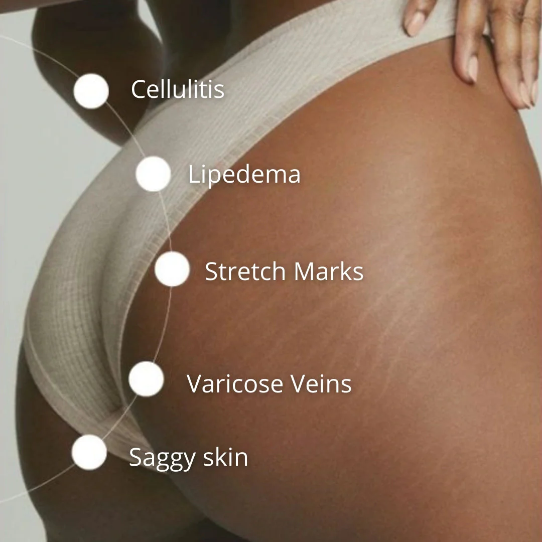 Cellumove Multifunctional Cream 300g - Image 6