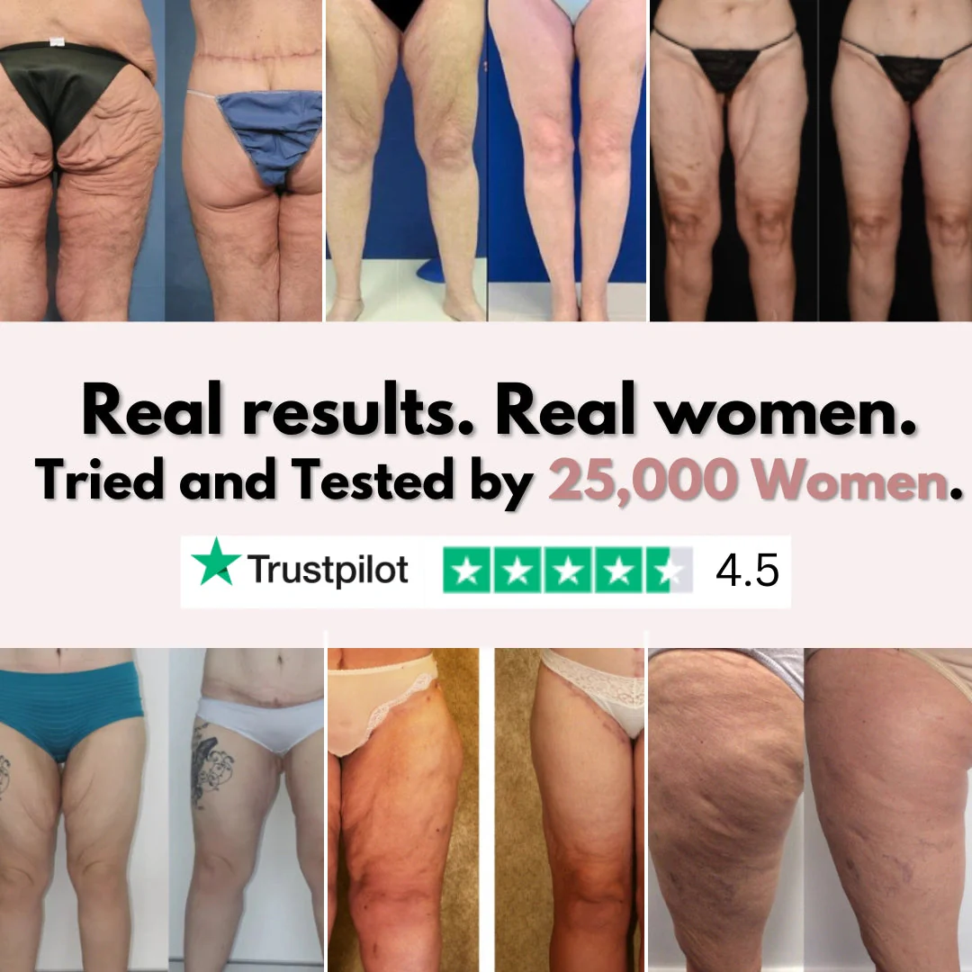 Firmer, smoother legs in 14 days — for women tired of saggy skin holding them back - Image 7