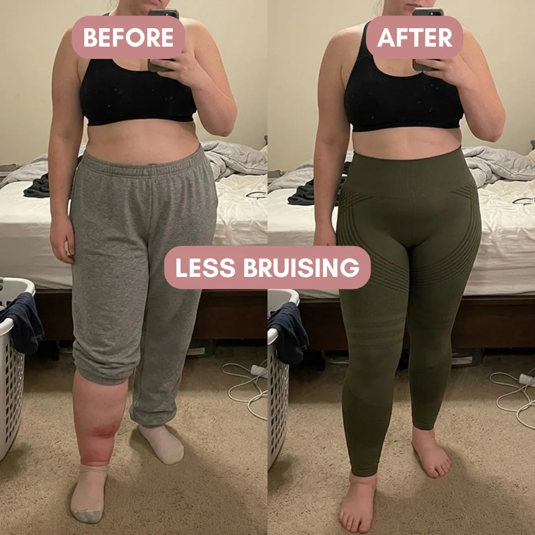 Cellumove 3D Legging – For Legs That Felt Like Anvils - Image 3