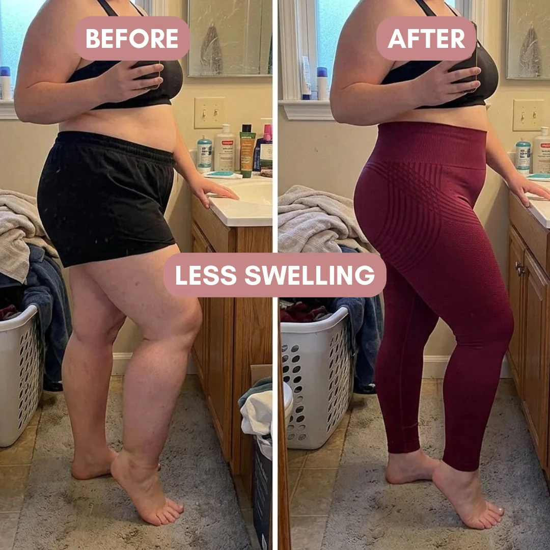 Cellumove 3D Legging – For Legs That Felt Like Anvils - Image 4